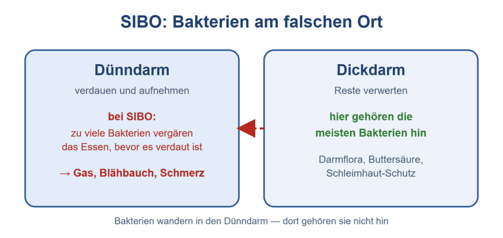 Schaubild: Bei SIBO sitzen zu viele Bakterien im Dünndarm und vergären das Essen, bevor es verdaut ist – Gas und Blähbauch